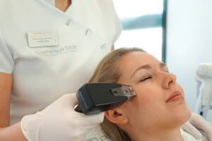 Acne laser behandeling steenwijk